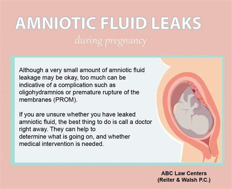 does amniotic fluid leak|Leaking Amniotic Fluid: Signs, Causes, and。